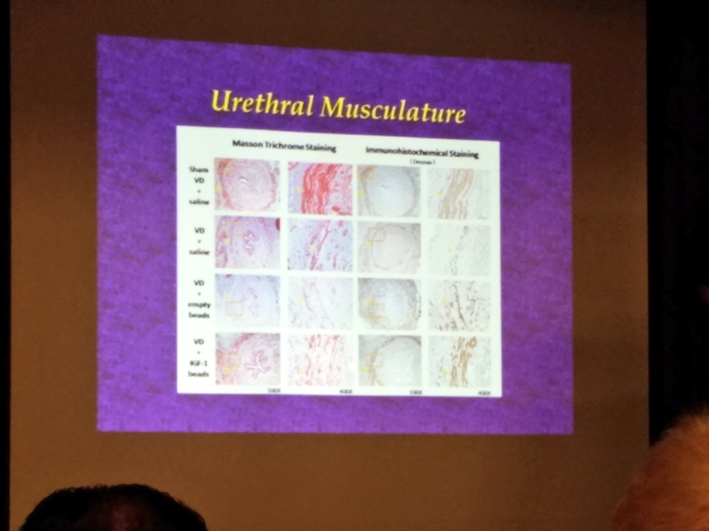 Hannan_Lab's tweet photo. @MDamaser shows periurethral admin of IGF1 microbeads preserves urethral structure/function in rat SUI model @Soc4PelvicRes #SPR2016 https://t.co/aKaeKF0w6b