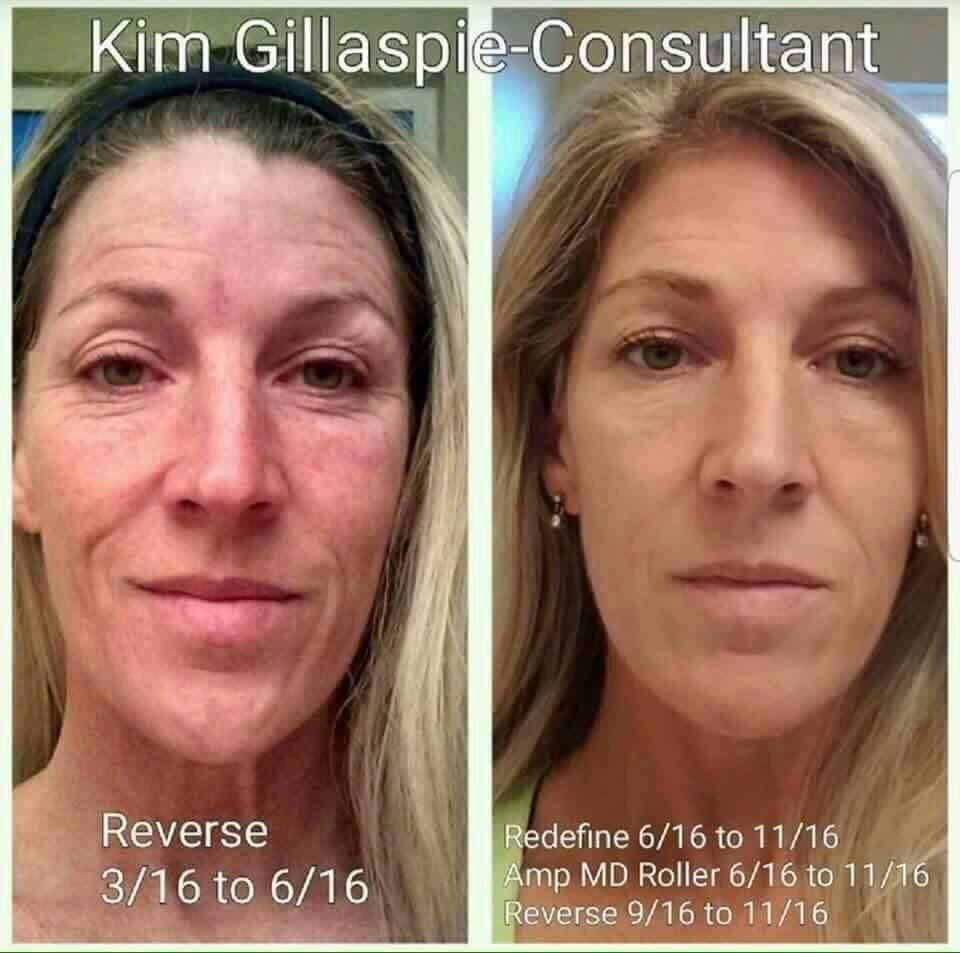 MSRodanFields's tweet image. Reverse the look of your skin with Rodan+Fields Premiun Skincare
marlysimon.myrandf.com
