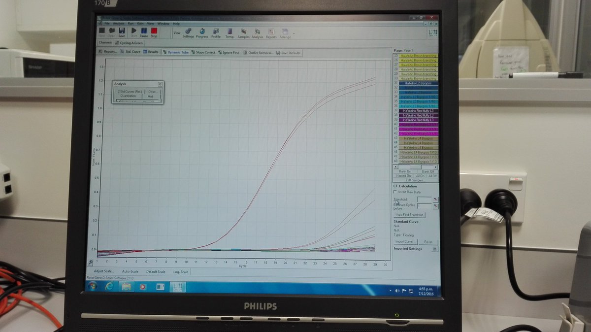 paargyle's tweet photo. Using #qPCR to identify #ciguatera related #microalgae communities in Tonga at @Cawthron_NZ  #research #phd #habs https://t.co/4gKAPuouk1