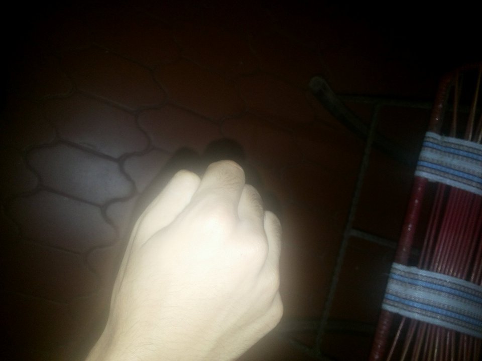 Davecardozo's tweet photo. #SiEresDiscapacitadoDasAsco Perdí mi dedo pulgar :( https://t.co/rjPDeEBcQ2