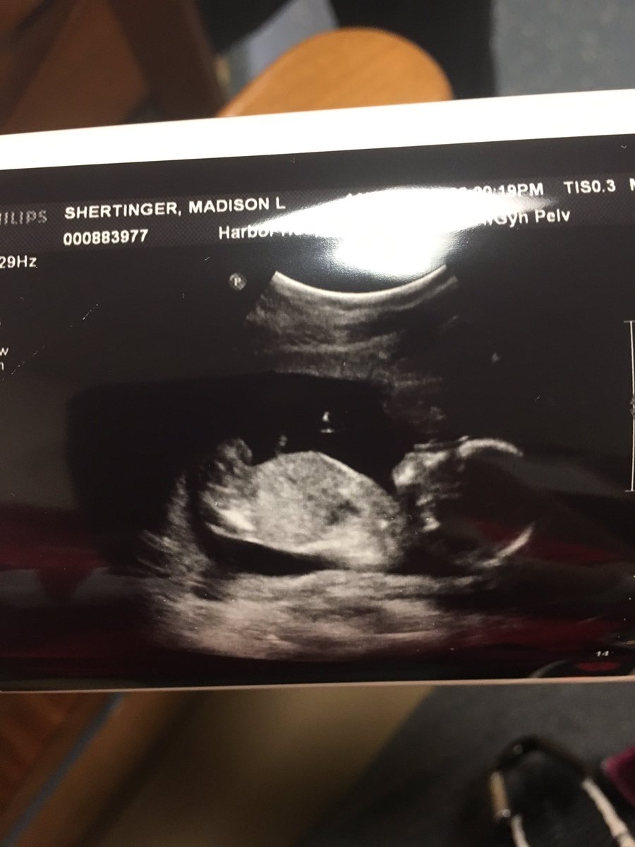 QueenMadi520's tweet photo. 18 weeks 😍👶🏻❤️ https://t.co/vNM3MiGU4o