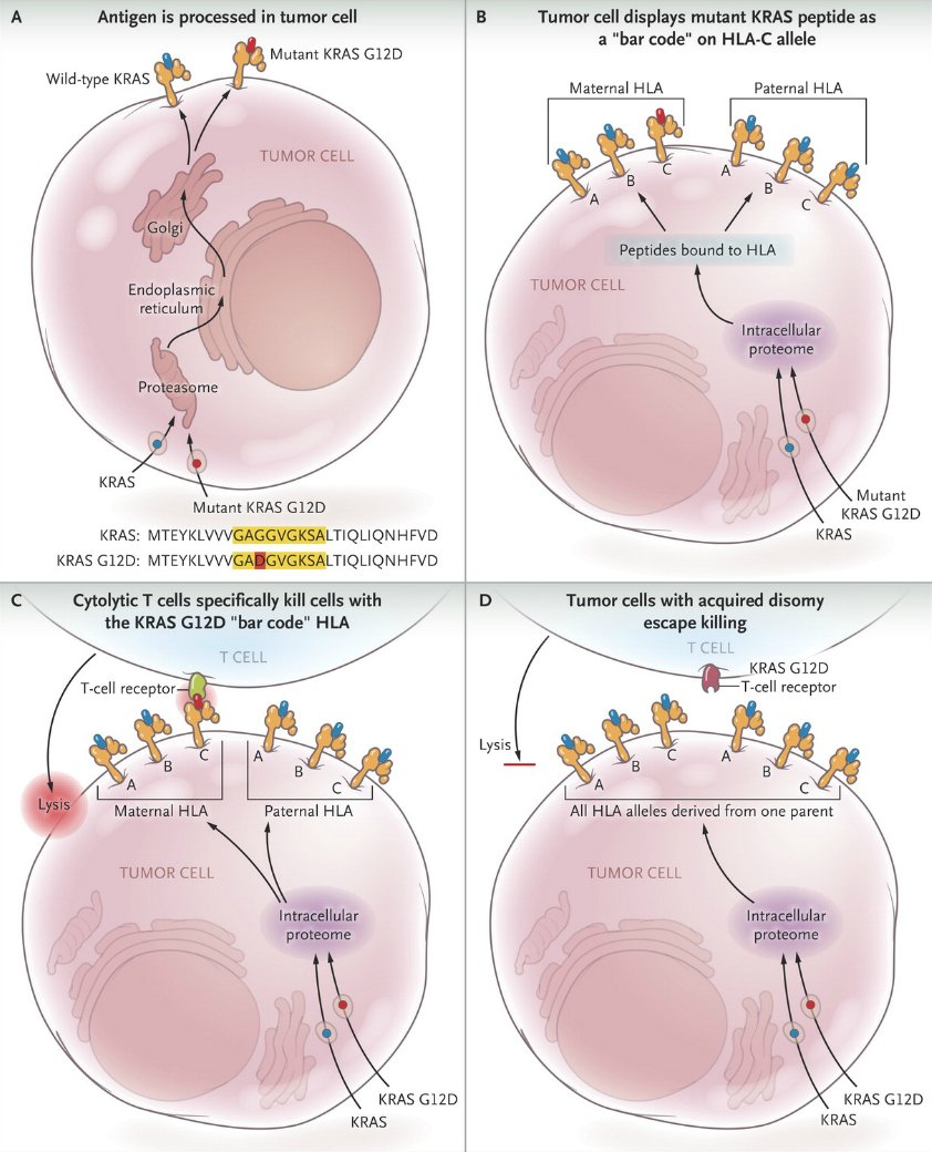Editorial: Drugging the Undruggable Ras — Immunotherapy to the Rescue? nej.md/2gbGQn3