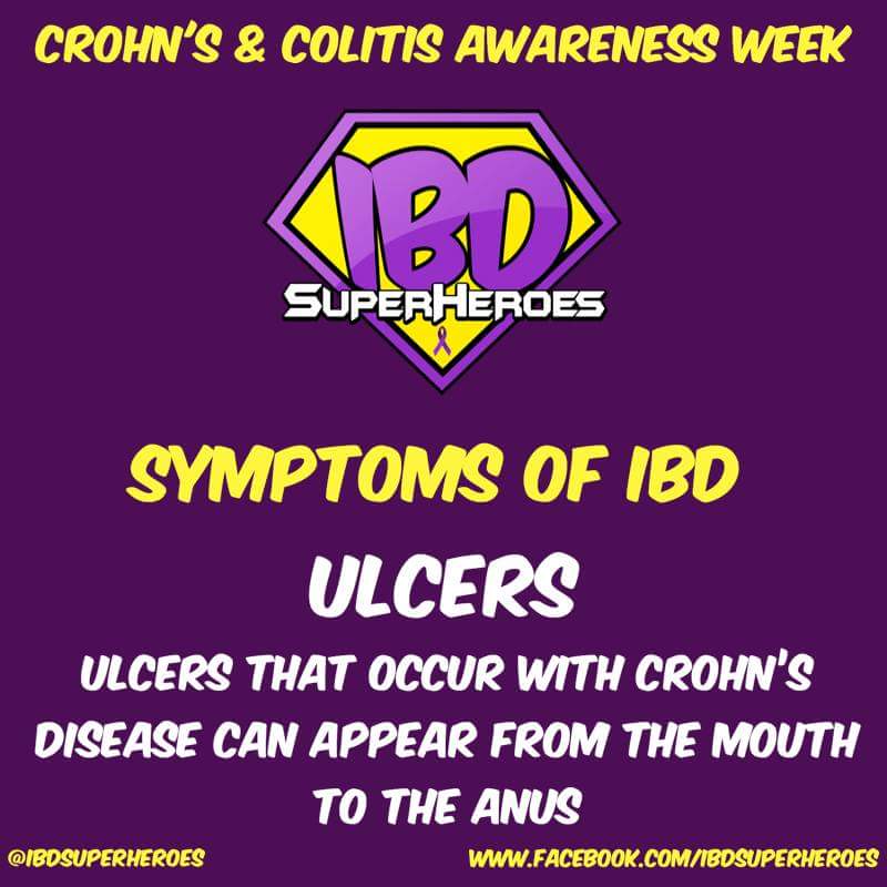 Sahara88uk's tweet photo. #Crohns can affect the whole #digestive tract
#Colitis affects only the #colon
#IBDSuperHeroes #1WeekOfIBD 
#CrohnsAndColitisAwarenessWeek https://t.co/m4uWeSdenK