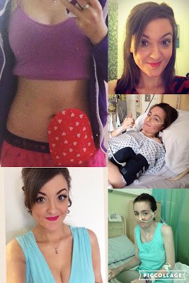 Sahara88uk's tweet photo. Your #IBDSuperheroes stories - @Lisakate86
https://t.co/vLt8xa3mTI
#CrohnsAndColitisAwarenessWeek #1WeekOfIBD
#Crohns #Colitis #IBD https://t.co/7u1Ghi0TvH
