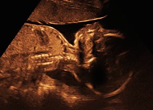 RELEVANT's tweet photo. Ohio just passed a law that makes abortion illegal at the moment a heartbeat can be detected. :https://t.co/UHYPVtnJsp https://t.co/fadECT0H87