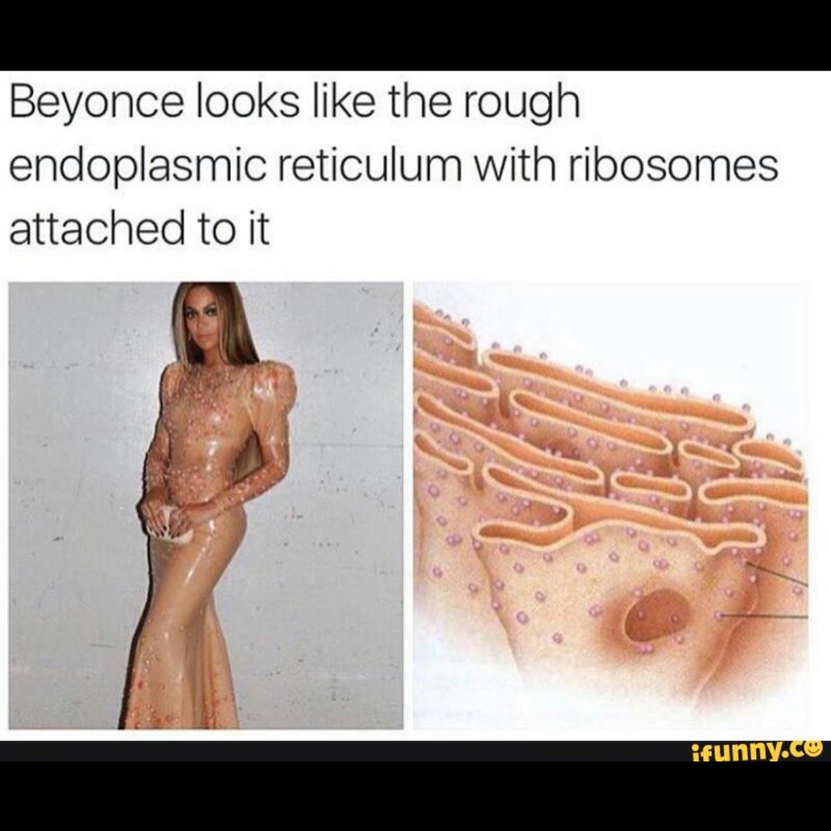 TheCytoBro's tweet photo. @E_R_babayyyy #RHSOrganelleWars sorry it's the truth https://t.co/DC4QYQZ4rJ
