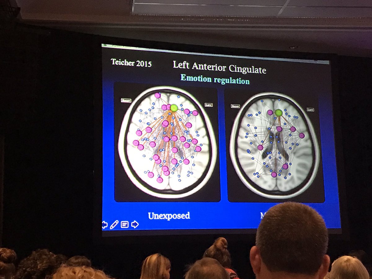 BarnPsykologen's tweet image. Alterations in Brain structure in traumavictims. Bessel van der Kolk explains. #ZEROTOTHREE2016 #thinkbabies @ZEROTOTHREE