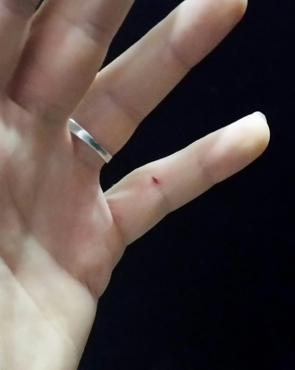arash_arabi's tweet image. got injured trying to pop from the #stack #programmerstyle