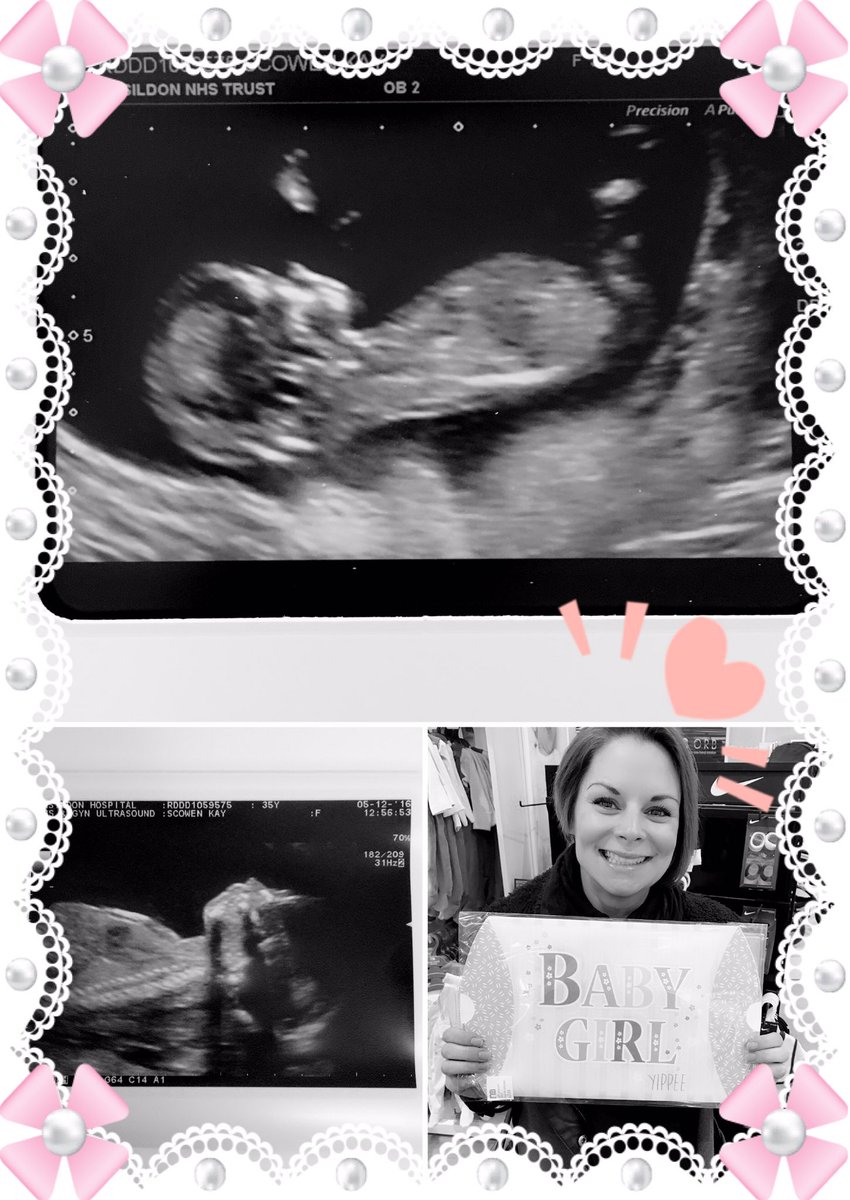 BouncingBumps's tweet image. To every expectant Mum/Parent, we have recently found out that we are expecting a little Girl 👶🏻🎉💝💕 #pregnantbelly #Pregnancy #babies