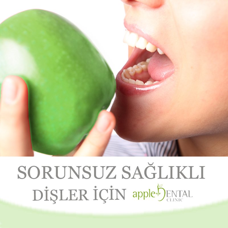 AppledentKlinik's tweet photo. https://t.co/sdIGaK6hFn https://t.co/Daq4S1yg0t