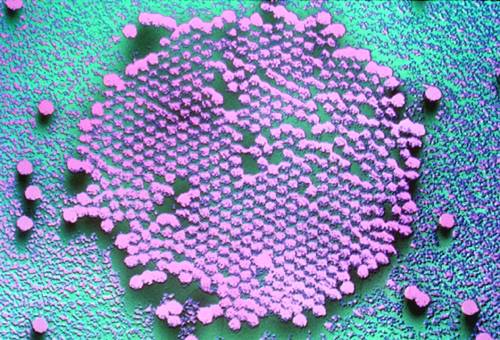 BiggoneDotCom's tweet photo. 5 Most Lethal #Diseases that Have No Cure - https://t.co/ofOnRwUtAH - #Death #Medical #MostLethalDiseases https://t.co/RwjV65sNZp