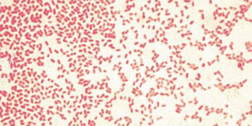 Microbiology_LR's tweet photo. #Pathogenic #biofilms disrupted by #pyocyanin - a #bacterial #protein. Research may aid #cysticfibrosis therapies https://t.co/9PKpMcDwSm https://t.co/YQ21EmksYK