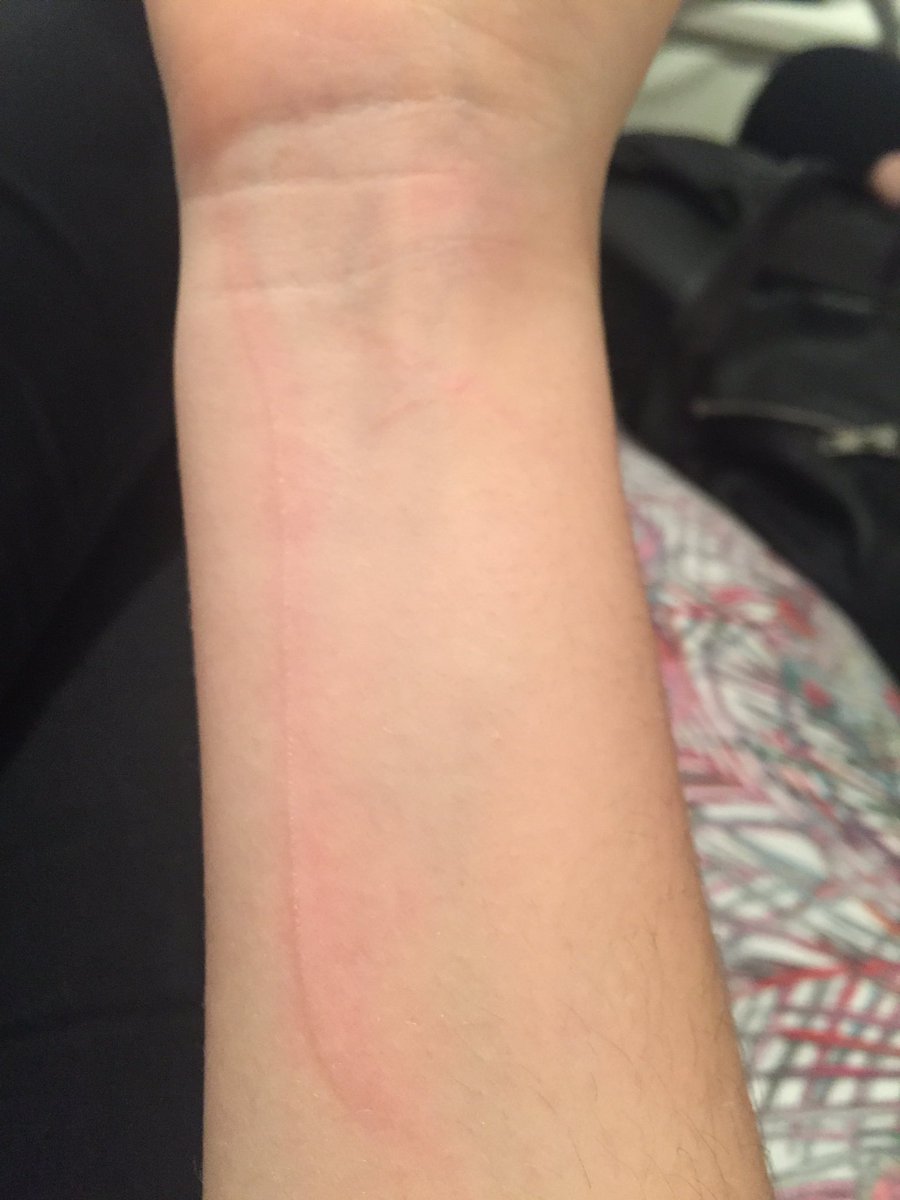 ScrambledAshton's tweet photo. @soph_llewellyn is abusive to me #saveashton https://t.co/akjvEuF4Ve