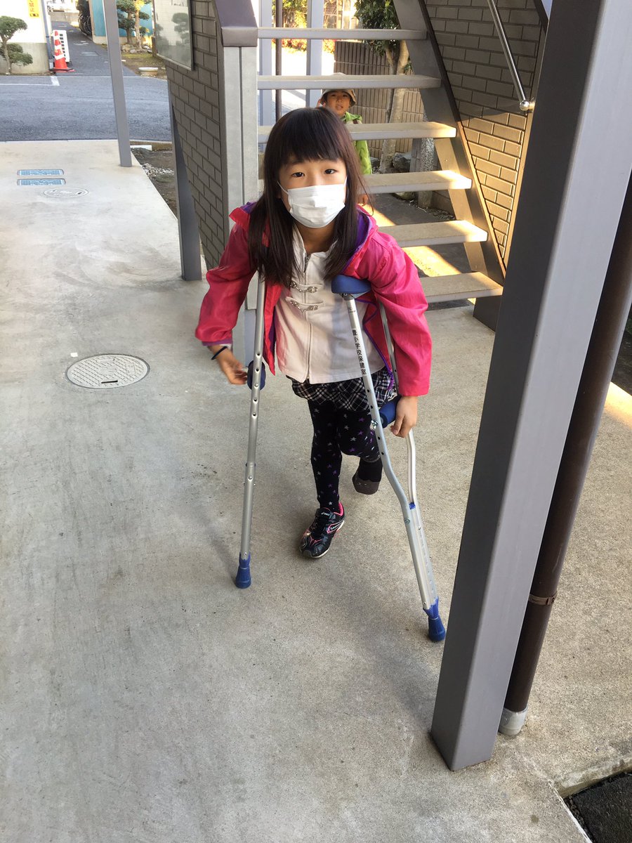 Yoshimi En Twitter 娘 人生2回目の骨折 遊んでる時ひねって左足くるぶしの下の骨折りました 持久走大会終わった後でホント良かった 全治1ヶ月だから新春マラソンには練習なしでギリ間に合う 学校と病院ダブルで借りちゃって松葉杖2セットだから悠も Yoshimi En Twitter 娘 人生2回目の骨折 遊んでる時ひねって左足くるぶしの下の骨折りました 持久走大会終わった後でホント良かった 全治1ヶ月だから新春マラソンには練習なしでギリ間に合う 学校と病院ダブルで借りちゃって松葉杖2セットだから悠も