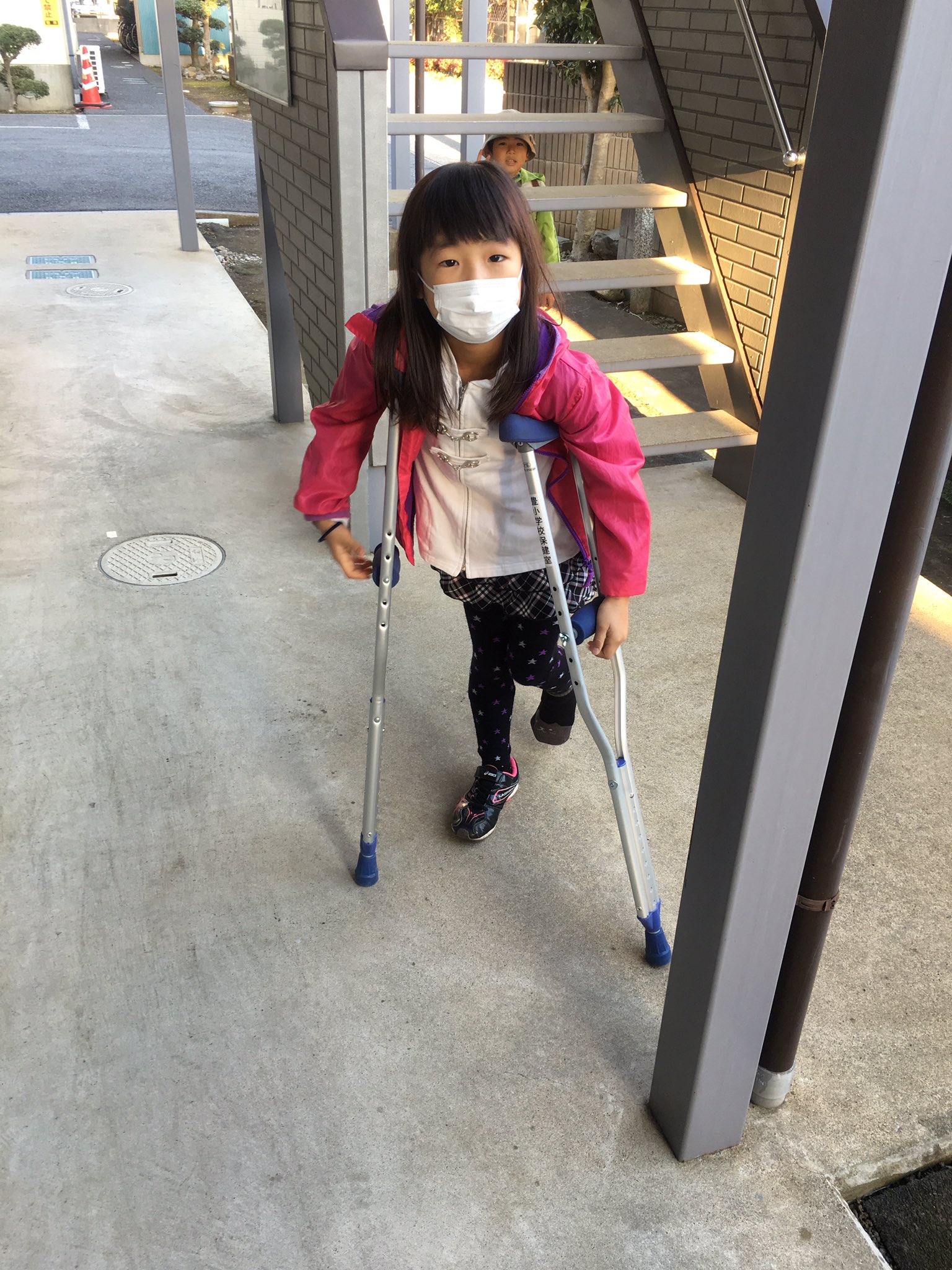 Yoshimi 娘 人生２回目の骨折 遊んでる時ひねって左足くるぶしの下の骨折りました 持久走大会終わった後でホント良かった 全治１ヶ月だから新春マラソンには練習なしでギリ間に合う 学校と病院ダブルで借りちゃって松葉杖２セットだから悠も