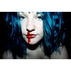 xthreebullets's tweet image. It's just a random nose bleed, but Chloe won't tell people that.