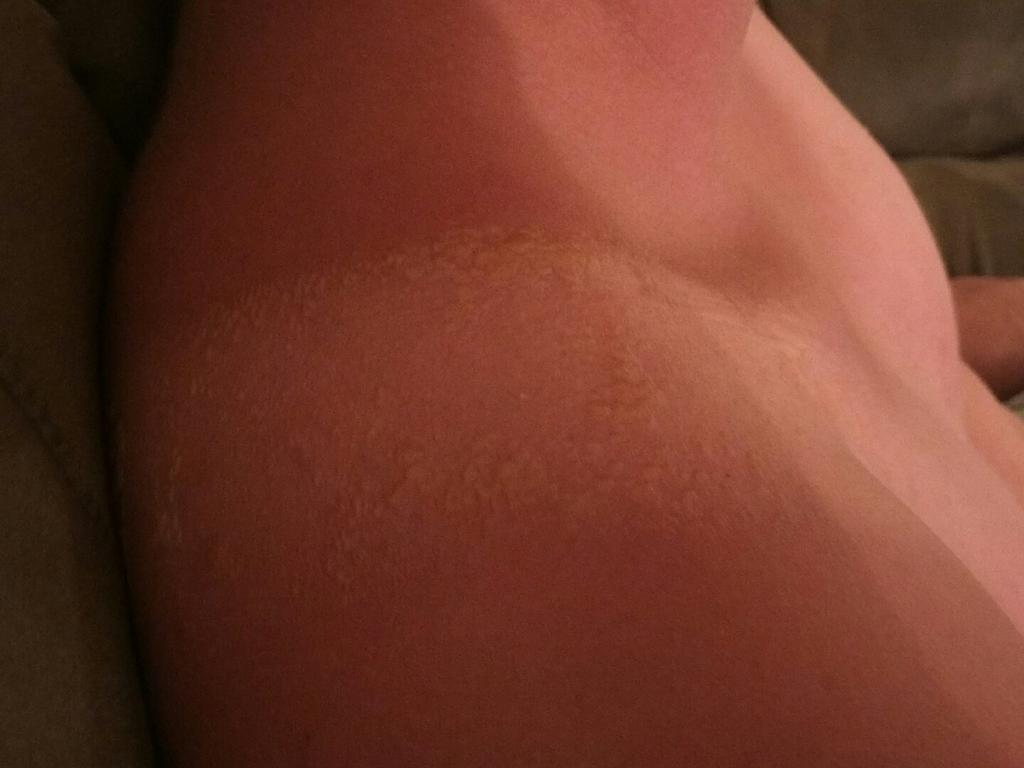 Ali_Napper's tweet photo. @jas_faires at least my vest tan isn't blistering like this cock's https://t.co/oCEWWQKzpD