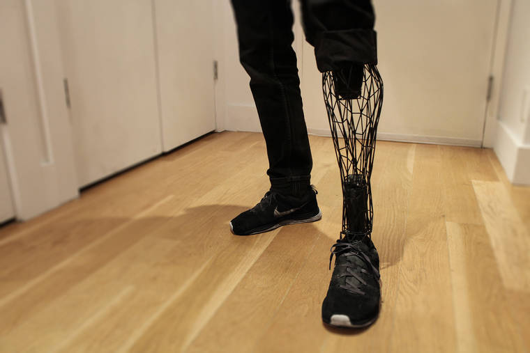 Exoprostheticleg Hashtag On Twitter