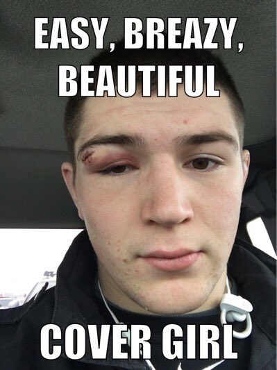 josephmessare's tweet photo. When the doctors are trash and putting in stitches https://t.co/fwvQtF7Fsh