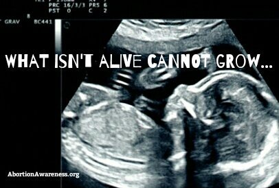 What isn't #alive can not grow. 
#DoesTheUnbornHaveLife
#AbortionAwareness