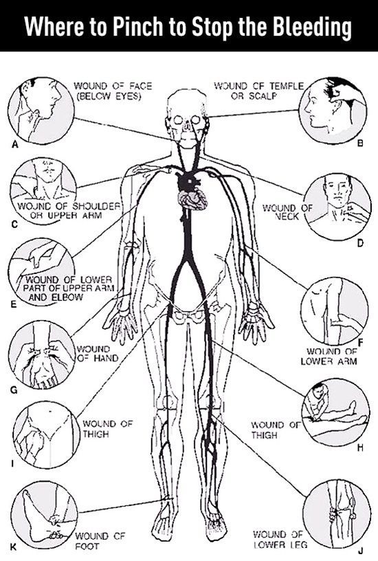insidefirstaid's tweet image. Where to Pinch to Stop the Bleeding. To control bleeding, we recommend the use of hemostatic agents bit.ly/quikclot #quikclot #celox