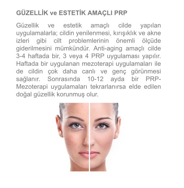 drulkusarpkaya's tweet photo. https://t.co/oRKtk5BDGK