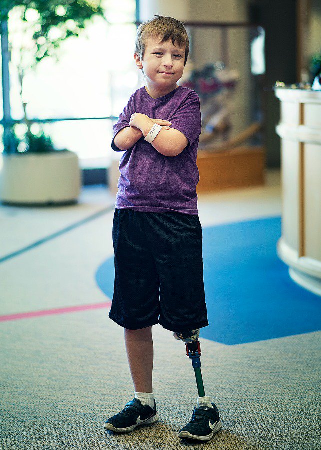ShrinersChicago's tweet image. Nicholas learned to walk thanks to prosthetics. His story in #leadersincare. Our hospital magazine: bit.ly/2htuUiQ