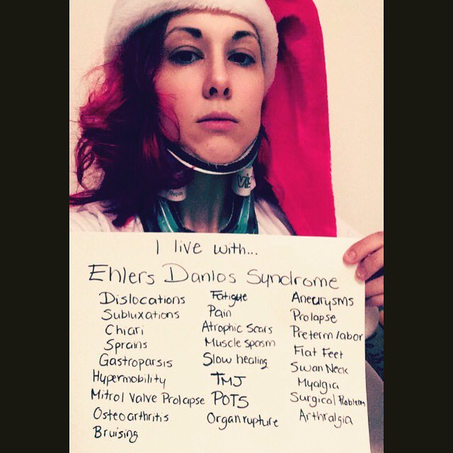 AnnaWerrun's tweet photo. @Ehlers__Danlos @TheEDSociety @me_and_my_EDS @ehlersdanlosuk @Ehlersdanlos #EhlersDanlossyndrome #EDS #ehlersdanlos #edsaware https://t.co/sdgy2v4uLd