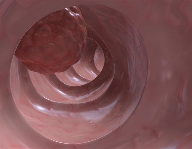 CleanMyColon's tweet image. Majority of U.S. adults age 50 and over fail to take colon cancer screening cur.lv/142lg0