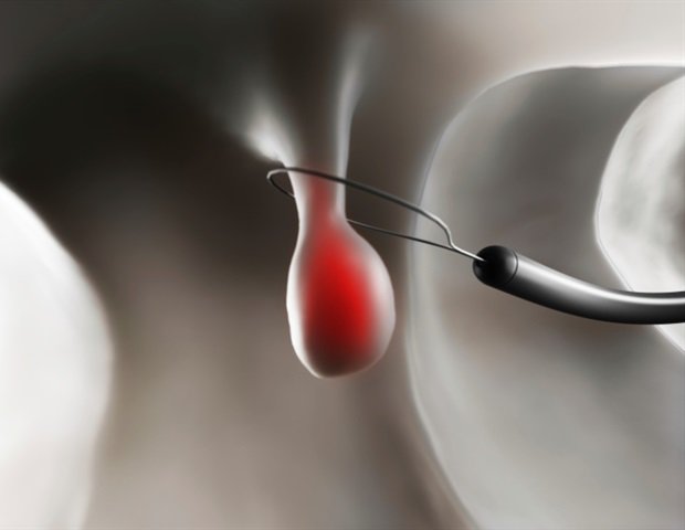 CleanMyColon's tweet image. Ferring Pharmaceuticals receives FDA approval for new colon-cleansing drug cur.lv/142lg4