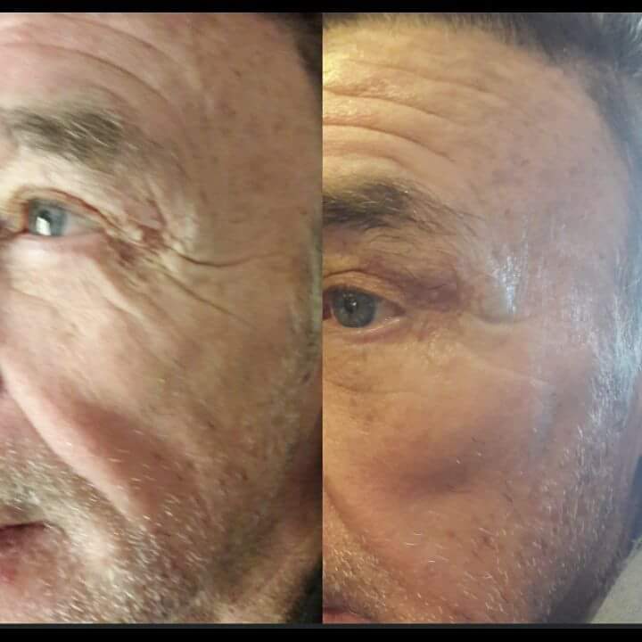 WOW WAHNSINN😱❗ Kunstwerk an der Boxlegende Rene Weller mit Dr. Juchheim Cosmetic ⛧ Auch Promis lieben es 😍 #drjuchheim #antiageing #boxing