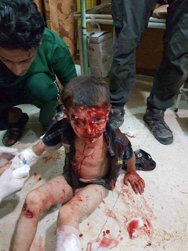 tariharsivi's tweet photo. Kimimiz fotoya bakamayacak, kimimiz görmezden gelecek ama şu bilinsin ki; mahşer günü 
Halep'ten sorulacağız! #DünyaDuysun https://t.co/W28CRSDs10
