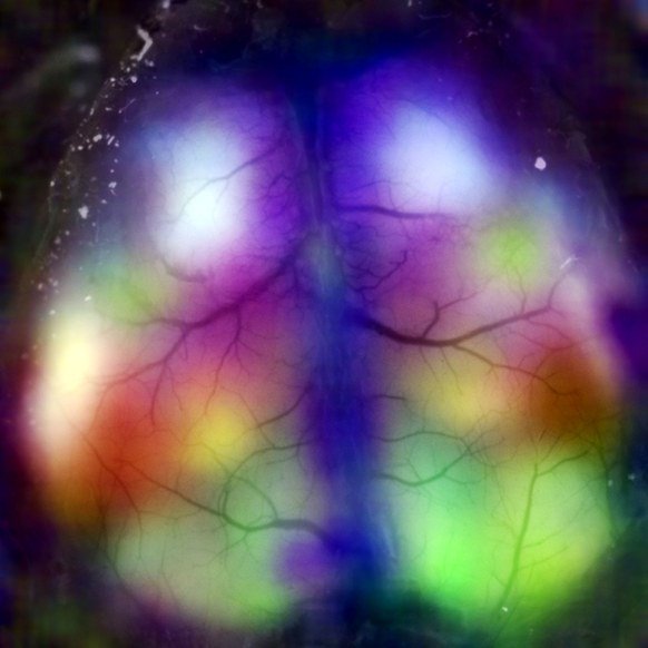 InnovaMap's tweet image. Watch a resting brain light up with activity @WIRED ow.ly/KVgO3075BzK #neuroscience #neuralpatterns