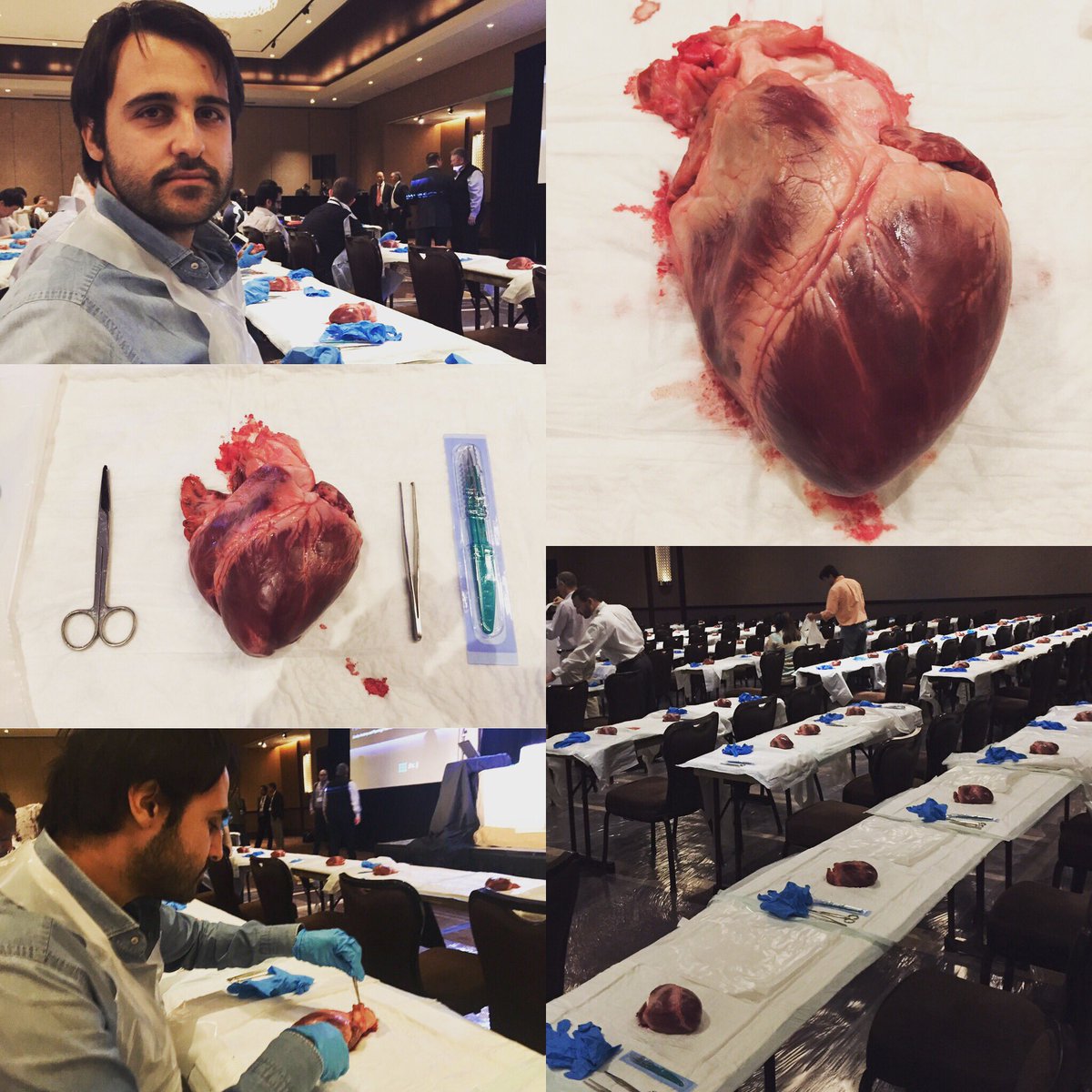 Terrific heart dissection session - focus on #StructuralDisease @ #SCAIFIT16 #SCAI #LasVegas #Cardiology #Unime #EAPCIYoung #GISEYoung