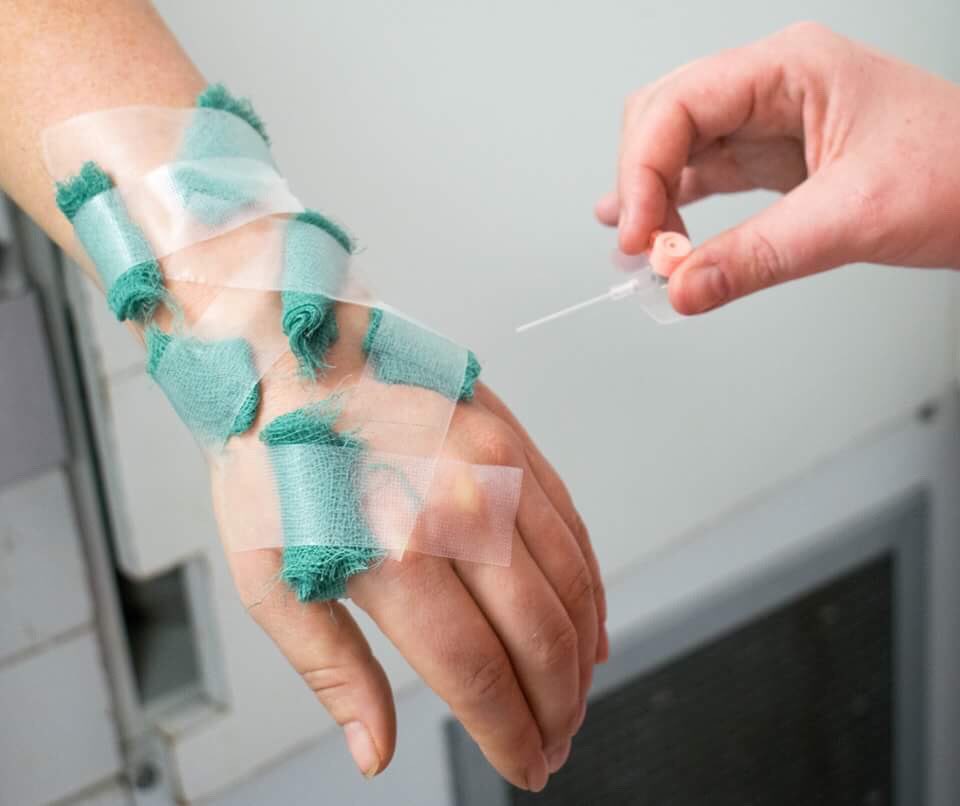 NHS's tweet photo. On the 6th day of Christmas my Anaesthetist gave to me.....6 failed cannulations https://t.co/HB9hepZiiY