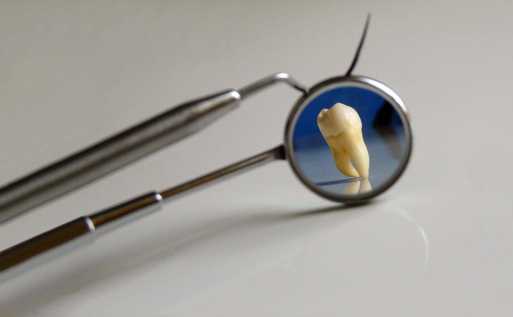 surgilane's tweet photo. Surgilane Instruments Inc. #supplies #dental #instruments worldwide. Visit us on https://t.co/as2NjzqJv9 | #surgilane™ #orthodontics #orthodontia #orthodontist #dentist #dentalsurgeons #dentalhospitals #periodontist #odontologia #medicaldevices #prosthodontist #endodontist https://t.co/bSxawfDKvf