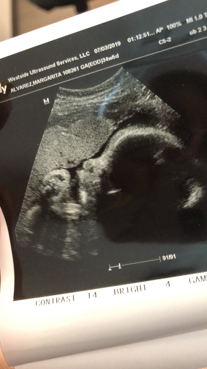 MaggieCa3's tweet photo. We are almost there and I have a mix of feelings. #35week https://t.co/W6Q5oQJnQD
