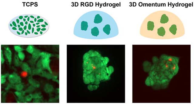 AdamEnglerUCSD's tweet photo. #ICYMI: Hydrogel system to ID drivers of drug resistant ovarian #cancer via @peytonlab, @UMassAmherst  and @AIP_Publishing. #CancerResearch #APLBioengineering https://t.co/6Ts9FVoVCt https://t.co/C71D5MVkCN
