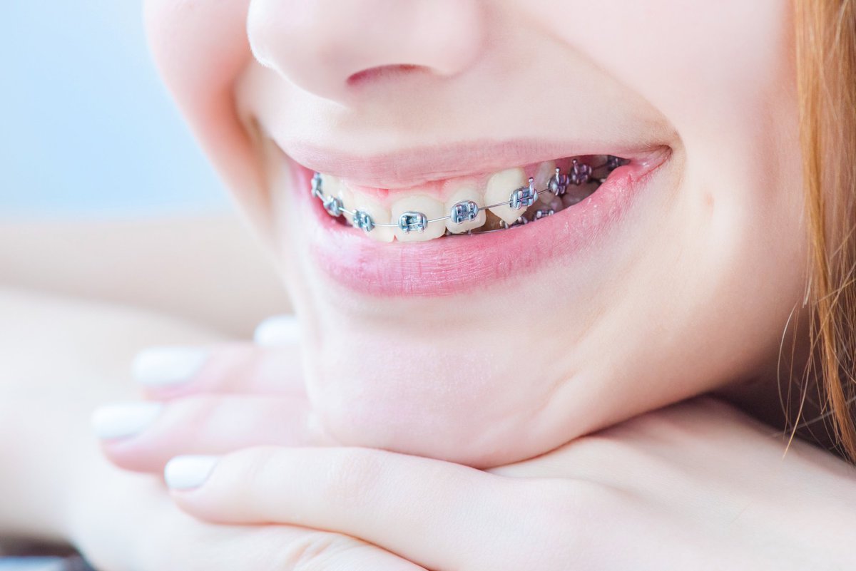 SnodgrassKing's tweet photo. At Snodgrass-King, we pride ourselves on not only creating beautiful smiles, but just as importantly providing functional bites. Learn more about our Orthodontic services: https://t.co/l3gO28Pm13 https://t.co/E8wntzjAEZ