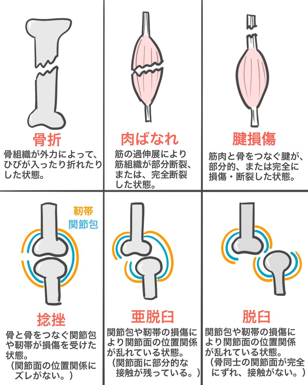 ゴロ 解剖生理イラスト 在 Twitter 上 イラストで分かる 骨折 肉ばなれ 捻挫 脱臼 腱損傷の違い T Co Defnn0uug9 Twitter