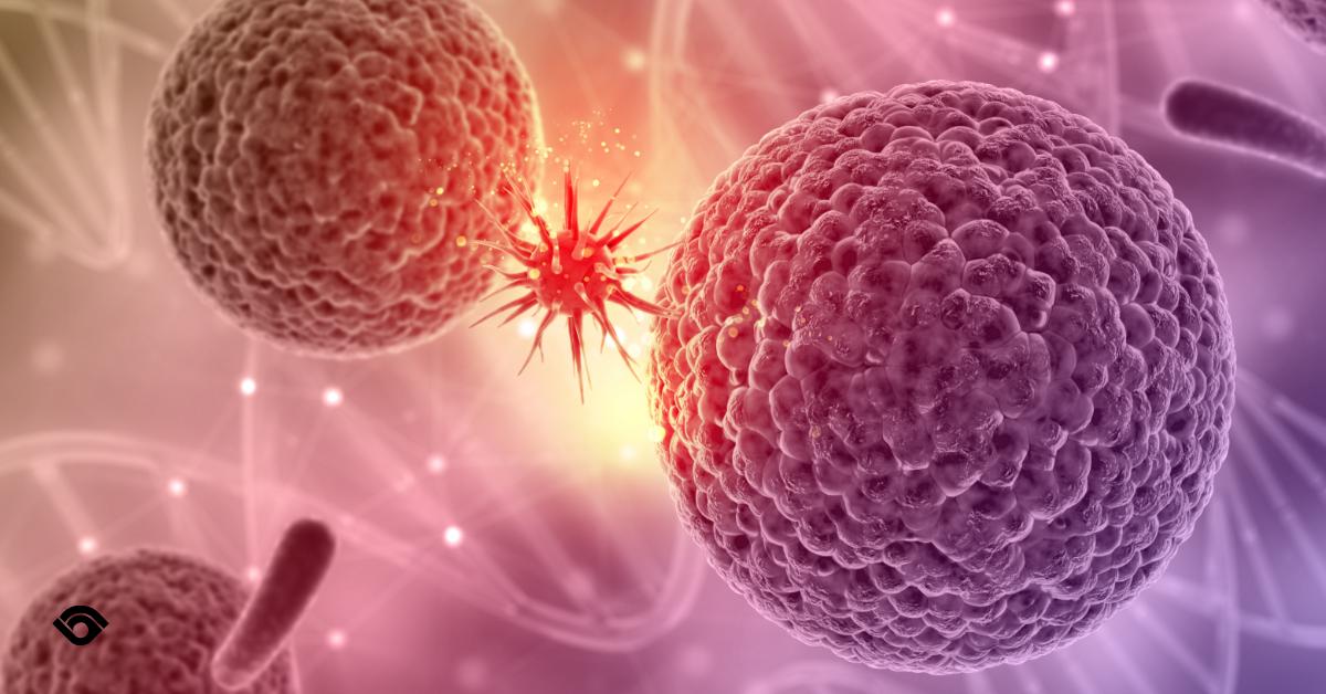 #Testis kanseri genelde testiste bir yumru ile kendini gösterir ve kendi kendine #muayene yoluyla bulunabilir. #Afrika ve #Asya kökenli erkeklerde görülme olasılığı daha düşüktür.

Bu konu hakkında daha fazla bilgi edinmek için videomuzu izleyebilirsiniz.

ow.ly/wvBZ50uVdGY