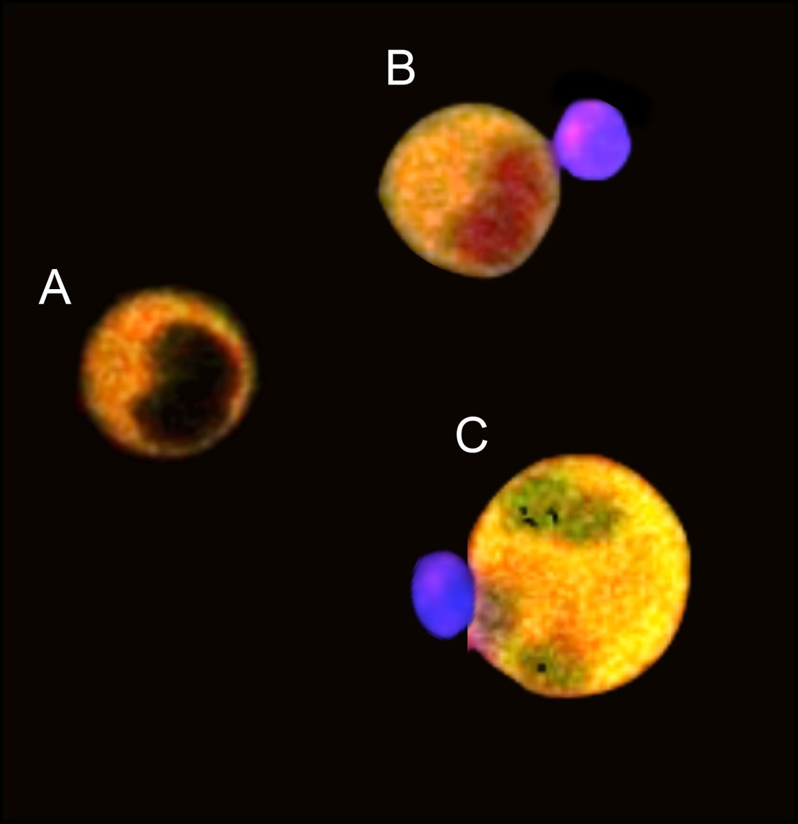 IfADo_info's tweet photo. NK cells eliminate virus-infected &amp; tumor cells by using different cell death pathways. Working with an international research team, IfADo's immunologists demonstrated that the pathways are differentially regulated during NK cell serial killing.@JExpMed https://t.co/ZgA0J6Aw7y https://t.co/P27OYMNe8r