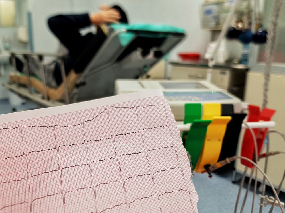 ECG_MK's tweet photo. So pleased to be able to offer this #online #ECG training for #GPs (and other healthcare professionals who already have a basic understanding of ECGs.)
This is the next level up - we hope it helps
Written by our own @ECGSarah
https://t.co/O9JwZEuIhd? https://t.co/a7doJP8UvT