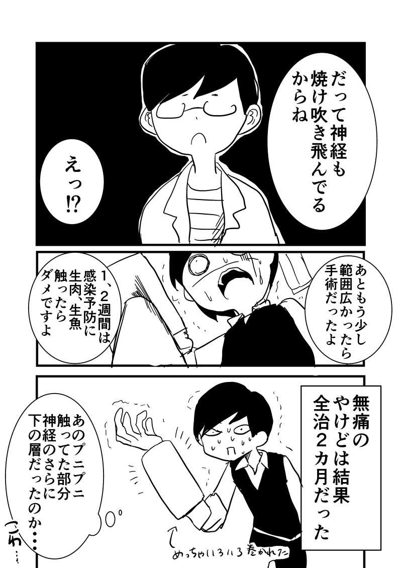 無痛のやけどは病院に行ったほうがいい。
#エッセイ漫画 #漫画 