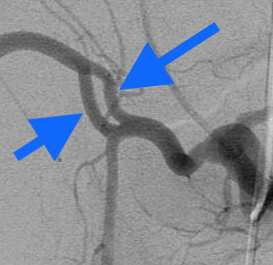 Nathan Ertel MD tweet media