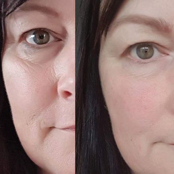 Your real results say it all. Share your AHA skin transformations with the hashtag #NutriResults and #MyPowerPeel