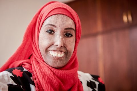 FarahKhaleck's tweet image. I was interviewed by @Barcroft_TV for their Shake My Beauty series. Watch it: youtu.be/yz8SwNrKRRc
Massive thanks to the entire team. Pic: Juozas Cernius/Barcroft Tv
#KnowScleroderma #InspireLife