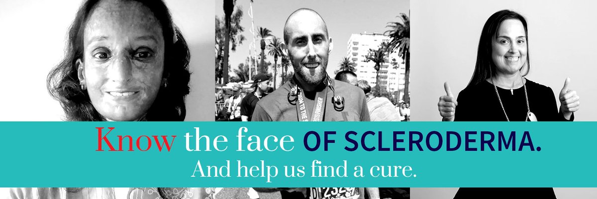 CastleCreekBio's tweet image. Know the face of #scleroderma. Learn the facts to share with others to raise awareness #SclerodermaAware bit.ly/2IQdkEK