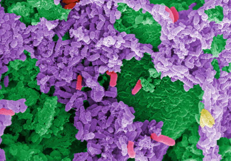 sciencePNNL's tweet photo. Three Studies Track People’s #Microbiomes Through #Health and #Disease:   https://t.co/FhVRxDmDGc @TheScientistLLC #HumanMicrobiomeProject #diabetes #IBD #science @OmicsPNNL #WorldMicrobiomeDay https://t.co/xea1Vbi79Q