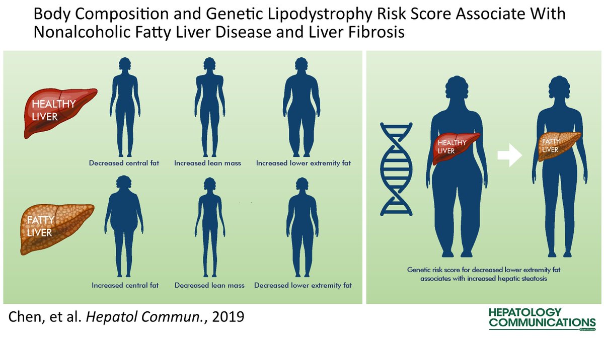 The latest #VisualAbstract from @vchenmd in @HepCommJournal: Body Composition and Genetic Lipodystrophy Risk Score Associate With Nonalcoholic Fatty Liver Disease and Liver Fibrosis ow.ly/Ld2i50uP7BV @GSzaboMD #AASLDjournals